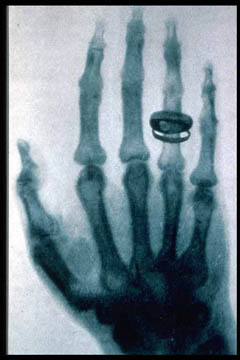 x-ray.jpg
